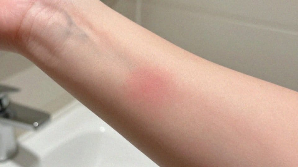 Czy hydrolat różany może powodować reakcje alergiczne?